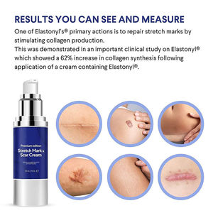 Crema Personalizada con Logotipo de Belleza Orgánica para <span class=keywords><strong>Embarazo</strong></span>, Antiarrugas, Blanqueadora, Suavizante, Hidratante, Elimina Cicatrices y Estrías - Product Image 2