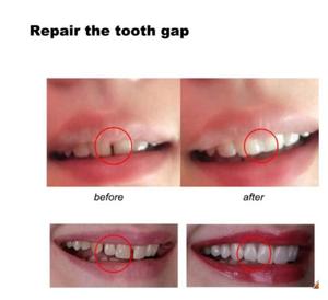 Kit de Reparación Dental Temporal de 10g/20g, <span class=keywords><strong>Dientes</strong></span> y Espacios Vacíos, <span class=keywords><strong>Dientes</strong></span> Postizos, <span class=keywords><strong>Pegamento</strong></span> Sólido, Adhesivo para Dentaduras Postizas, Blanqueamiento Dental, Herramienta de Belleza Dental - Product Image 4