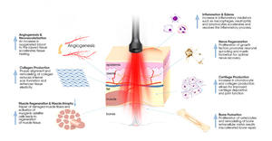 Veterinaire chirurgische & therapeutische lasertherapie-apparaat 810nm 980nm Klasse IV 10w-30w voor dieren, snelle herstel - Product Image 6