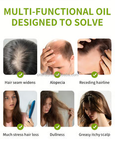 Lemon Mint Rosmarin Pflanzen extrakt Ätherisches Öl Haarpflege Kopfhaut Natürliche Kräuter Anti Loss Haar Ätherisches Öl für Männer und Frauen - Product Image 6