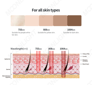 เครื่องกำจัดขนด้วยเลเซอร์ไดโอด Moonlight 808nm 4 ความยาวคลื่น 3 ระดับความยาวคลื่น 755 940 1064 808 ไตรเปิ้ลไอซ์ไทเทเนียม 2000w - Product Image 6