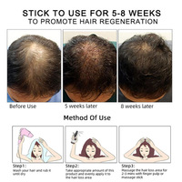 Losion Serum pelurus rambut, minyak Losion Serum penumbuh rambut, menipiskan rambut dan rambut rontok