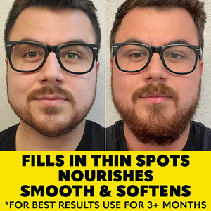 Nhãn hiệu riêng râu dầu bán buôn 100% tự nhiên hữu cơ làm mềm tăng cường người đàn ông chăm sóc chải chuốt Râu Phát triển dầu - Product Image 6