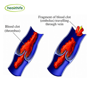 USA Lager Lager Algen extrakt Laminaria Japonica Seetang Extrakt 85% Fucoidan W. - Product Image 3