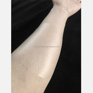 แผ่นปิดแผลแบบตาข่ายเคลือบใสชนิดใหม่ ขายดี ระบายอากาศได้ดี ขนาด 7x9 ซม. ได้รับการรับรองมาตรฐาน CE ระดับทางการแพทย์ คลาส 1 - Product Image 1