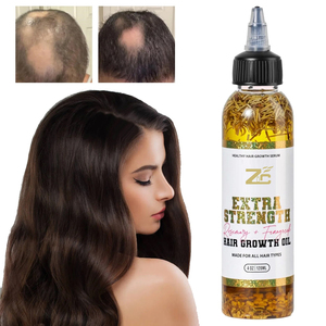 Özel etiket ekstra güç biberiye çemen tapu saç büyüme yağı HairTreatment gerçek bitkisel doğal saç tipleri Elixir - Product Image 1