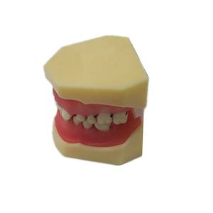 Modelo de enfermedad periodontal dental para educación modelo de diente de ciencia médica - Product Image 1