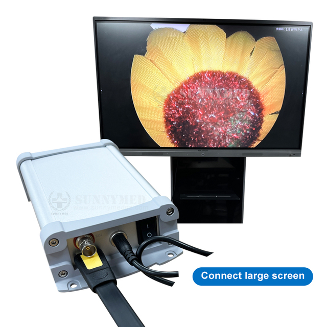 SY-P031HD5 High Quality Portable LCD Monitor All in One HD Endoscope Camera for ENT/Laparoscopy/Hysteroscopy/Urology