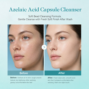 Detergente Viso all'<span class=keywords><strong>Acido</strong></span> Azelaico ed Estratto di Tea Tree, Idratazione Profonda, Sbiancante e Illuminante, Produzione Diretta - Product Image 2