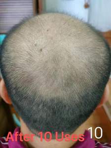 Vente en gros d'huile à base de plantes favorisant la croissance des cheveux Anti-chute Répare les cheveux abîmés Sérum hydratant pour le cuir chevelu Shampooing et après-shampoing - Product Image 4