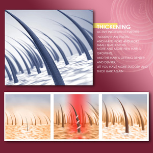 Custom Logo Natural Formula Scalp Nourishing <strong>Hair</strong> Growth Serum Red <strong>Onion</strong> <strong>Oil</strong> - Product Image 4