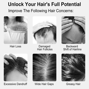 Rechargeable Microcurrent Scalp <b>Massage</b> Comb Electric Hair Care Brush for Hair Growth Scalp Relaxation Home Use - Product Image 5