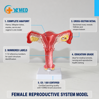 Modèle anatomique détachable de l'utérus et du bassin féminin humain, modèle pédagogique de gynécologie et d'obstétrique pour étudiants en soins infirmiers et en sage-femme, CE/ISO