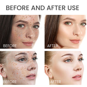 ESTELIN gemi hazır en çok satan 30 ml kuşburnu ve Niacinamide noktalar solma yüz serumu - Product Image 2