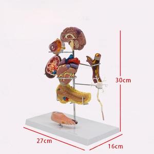 Modelo de Enseñanza Médica, Modelo de Diabetes para Educación en Endocrinología y Fisiopatología - Product Image 4