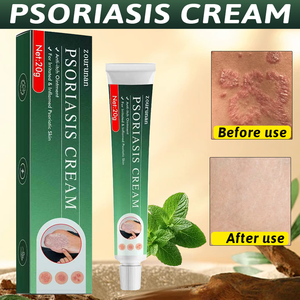 Crema Erboristica Zourunan per Psoriasi, Eczema e Dermatite, Cerotto Cinese per il Sollievo dal Prurito Cutaneo, OEM all'Ingrosso 20g - Product Image 3