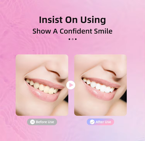 Tiras blancas médicas Blanqueamiento de dientes Etiqueta propia Sonrisa Tiras blanqueadoras de dientes 20 tratamientos-Esmalte seguro - Product Image 5