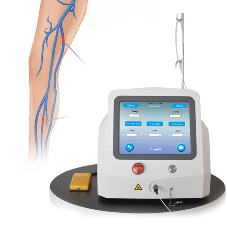 静脈瘤治療のためのレーザー治療による静脈内熱切除のための静脈瘤レーザー機