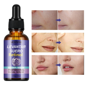 Suero Facial con <span class=keywords><strong>Retinol</strong></span> OEM y Vitamina VA VB VC VE, Ácido Hialurónico, Colágeno, Arroz, Baba de Caracol, Cuidado de la Piel MOOYAM, 10 Tipos de Suero Facial - Product Image 4