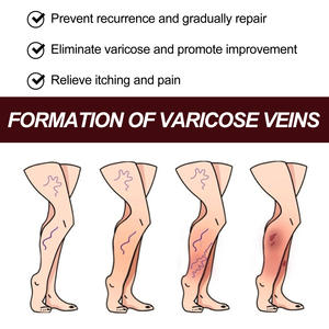 Descuento en crema reparadora de venas pierna azul bulto aliviar el dolor reparación varicosa crema reparadora - Product Image 4