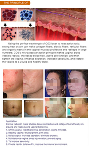 Appareil de thérapie laser pour l'inflammation gynécologique, les soins de santé privés, le blanchiment dentaire, le traitement des caries et la chirurgie des tissus mous - Product Image 5