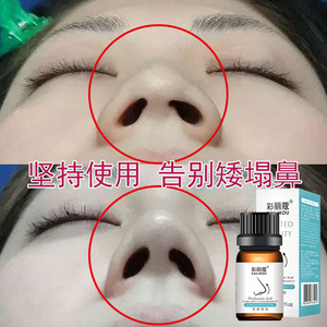 Les racines de montagne hautes et droites de vente chaude rétrécissent les ailes du nez soulèvent et hydratent l'huile essentielle de nez ferme et ferme - Product Image 5