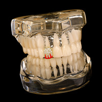 Grillz de Luxe Bling Dent Simple Vampire en Zircon Cubique Plaqués Or 14K Style Rapper Iced Out
