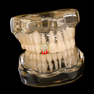 Grillz de Luxe Bling pour une <span class=keywords><strong>Dent</strong></span> Style Vampire en Zircon Cubique Plaqué Or 14K pour <span class=keywords><strong>Rappeur</strong></span> avec Diamants Iced Out - Product Image 4