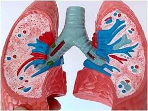 Khoa học y tế phổi khỏe mạnh của con người so với mô hình tương phản phổi bị bệnh nội tạng bóc tách giảng dạy - Product Image 2