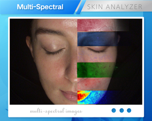 Analyseur de peau facial IA MC88 avec technologie de topographie 3D pour l'analyse de la pigmentation, de l'acné et des rides, affichage iPad, usage domestique et commercial, Cloud - Product Image 4
