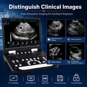 Appareil d'échographie portable avec écran LCD de 15 pouces, scanner de diagnostic vétérinaire avec SSD de 128 Go, système d'<span class=keywords><strong>imagerie</strong></span> clinique de 4,8 kg - Product Image 2