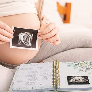 Custom Pregnancy Journal <b>Memory</b> Book Planner Hardcover Spiral <b>Gift</b> for Mom Art Durable Premium Quality Paper 100 Sheets Your - Product Image 4
