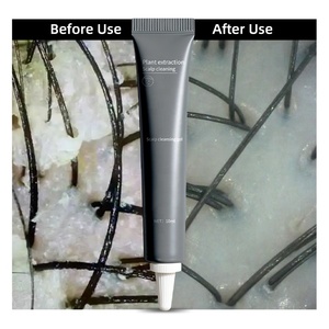 Gel Esfoliante per Cuoio Capelluto Professionale con Etichetta Privata, Formato da Viaggio 10ml, Detox per il Cuoio Capelluto - Product Image 3