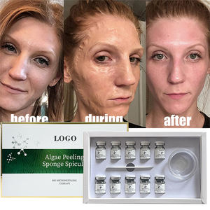 Spiculeshot 120000 Serum OEM PDRN Peptide Skin Rejuvenation Anti-aging Hydration Radiance Firming Deep Repair Liquid 30mL - Product Image 2