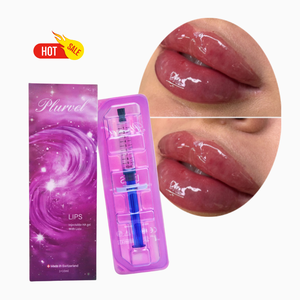 Relleno Dérmico Inyectable <span class=keywords><strong>de</strong></span> Ácido Hialurónico HA Filler <span class=keywords><strong>de</strong></span> 10 ml Directo <span class=keywords><strong>de</strong></span> Fábrica para <span class=keywords><strong>Aumento</strong></span> <span class=keywords><strong>de</strong></span> <span class=keywords><strong>Labios</strong></span> y Relleno <span class=keywords><strong>de</strong></span> Arrugas Faciales - Product Image 2