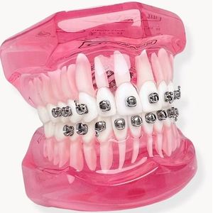 Nouveaux Appareils Orthodontiques Chinois Tiantian 2026, Produits Orthodontiques, Matériel Dentaire, Appareils Auto-Ligaturants - Product Image 2