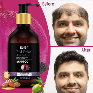 Venta al por mayor natural orgánico anti pérdida de cabello biotina Dht bloqueador crecimiento del cabello champú y acondicionador conjunto de suero tratamiento de pérdida de cabello - Product Image 6