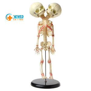 Medical Teaching Model Halloween Decoration <strong>Baby</strong> <strong>Skeleton</strong> Model 2-Headed Fetal <strong>Skeleton</strong> Deformity Newborn Infant <strong>Skeleton</strong> Model - Product Image 1