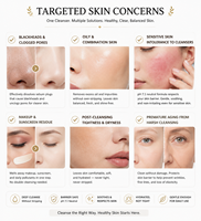 Nettoyant Visage Doux Contrôle Sébum et Élimination des Points Noirs à base de Glycéryl Glucoside, Sodium Cocoyl Glycinate et Bishdaa OEM