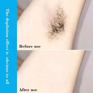 Crema <span class=keywords><strong>Spray</strong></span> Depilatoria Permanente Indolore Detvfo per Donne e Uomini - Product Image 5