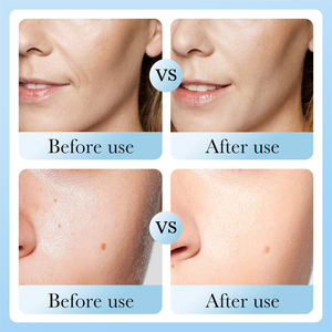 Limpiador Facial Espumoso con Ácido Hialurónico y Hinojo Marino <span class=keywords><strong>BIOAQUA</strong></span>, Control de Grasa, Hidratante, Antiacné - Product Image 5