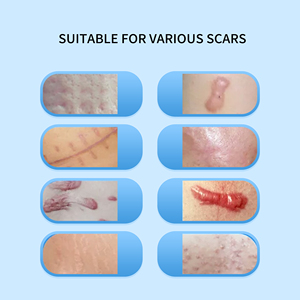 ZHUSHI Transparent de qualité médicale Ance enlever la cicatrice réutilisable enlever le ruban pour la beauté - Product Image 2