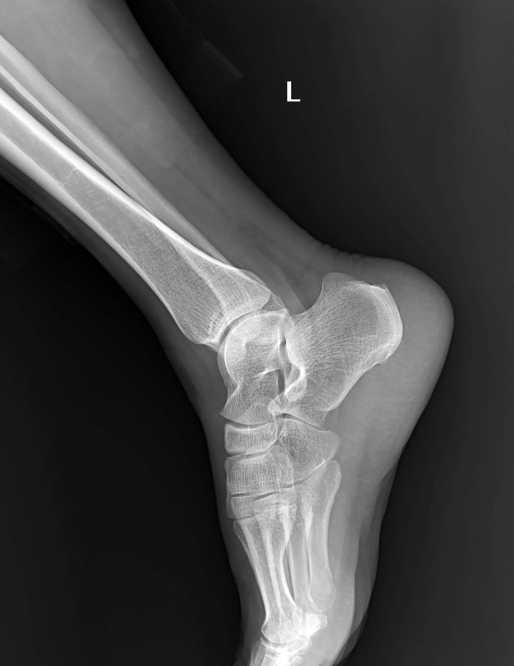 High Frequency Medical X-ray Machine With Digital System For Human