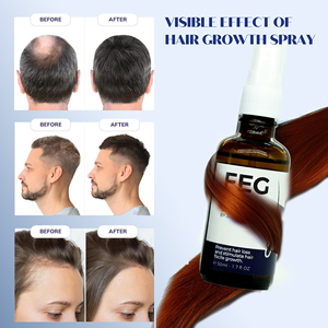 100% спрей для ухода за кожей головы - Product Image 6