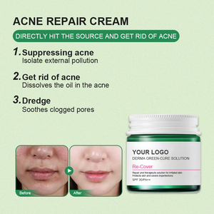 Solución para la piel grasa sensible Crema reparadora del acné Niacinamida Ácido salicílico Tratamiento calmante antimanchas Glicerina Aloe Vera - Product Image 3