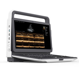 Draagbaar 3d4d Verloskundig Echografiesysteem Met Hartscreening-Volumetrische Imagin Voor Prenatale Diagnose Foetale Echocardiografie - Product Image 3
