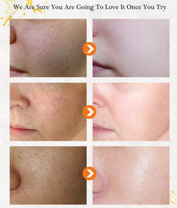 NOUVEAU Marque privée Crème blanchissante éclaircissante pour la peau noire à l'arbutine pour le <span class=keywords><strong>visage</strong></span> - Product Image 5