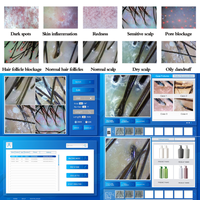 Macchina 5-in-1 per la ricrescita dei capelli con analisi AI del cuoio capelluto, massaggiatore elettrico e applicatore di siero per il trattamento della caduta dei capelli