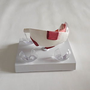 Modelo Anatómico Patológico del Ojo Humano, Modelo de Exhibición de Enfermedades de la Córnea para Enseñanza Médica - Product Image 6