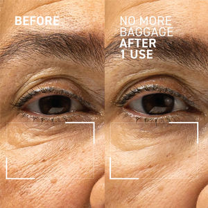 Meilleur soin oculaire Caffine Retino Ceramide Hydratant Élimination des cernes Anti-poches Rides Crème réparatrice pour les yeux Private La - Product Image 5